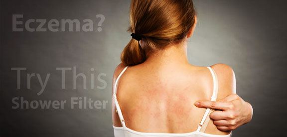 best-shower-filter-for-eczema