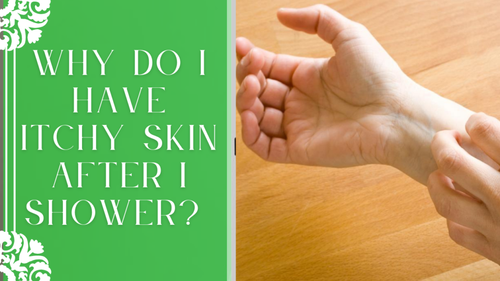 Why Do I Have Itchy Skin After I Shower?