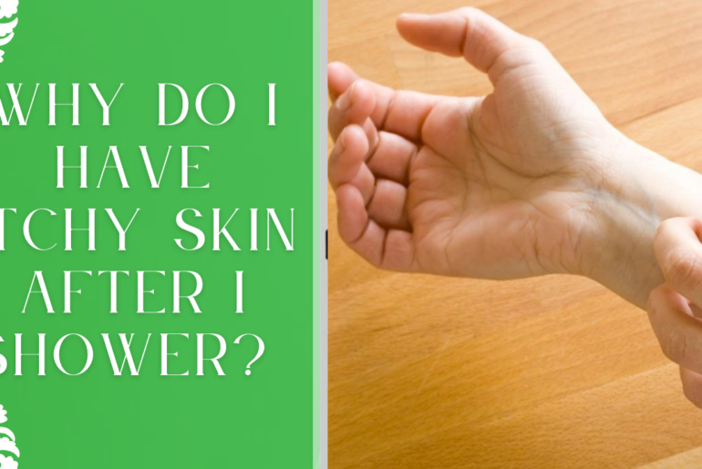 Why Do I Have Itchy Skin After I Shower?