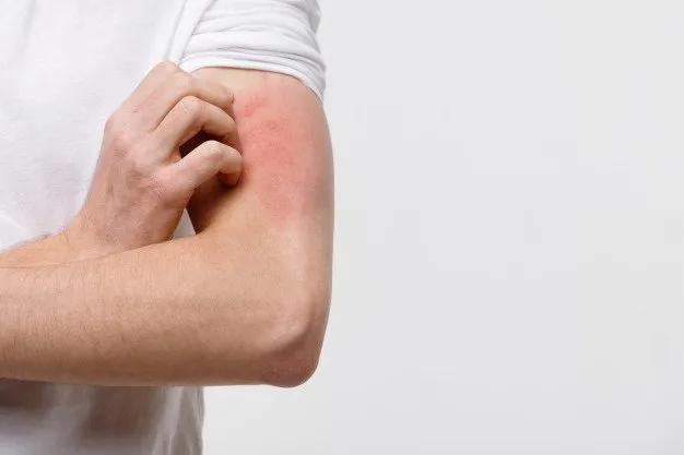 How Water Softeners Can Prevent Dry, Itchy Skin?