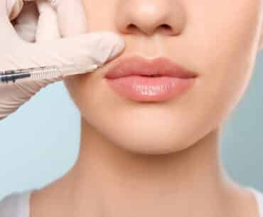 Lip Filler